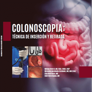 COLONOSCOPIA: Técnica de inserción y retirada